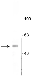 Anti-Vesicular GABA transporter (VGAT) Antibody