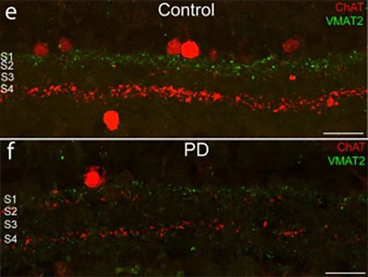 Anti-Vesicular Monoamine Transporter 2, C-terminus (VMAT2) Antibody - Image 2