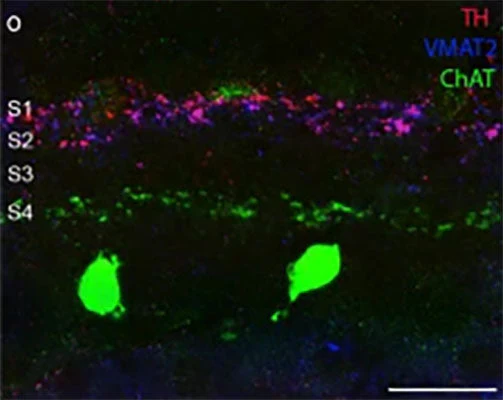 Anti-Vesicular Monoamine Transporter 2, C-terminus (VMAT2) Antibody - Image 3