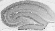 Anti-VGAT Antibody - Image 2