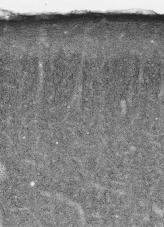 Anti-VGAT Antibody - Image 3