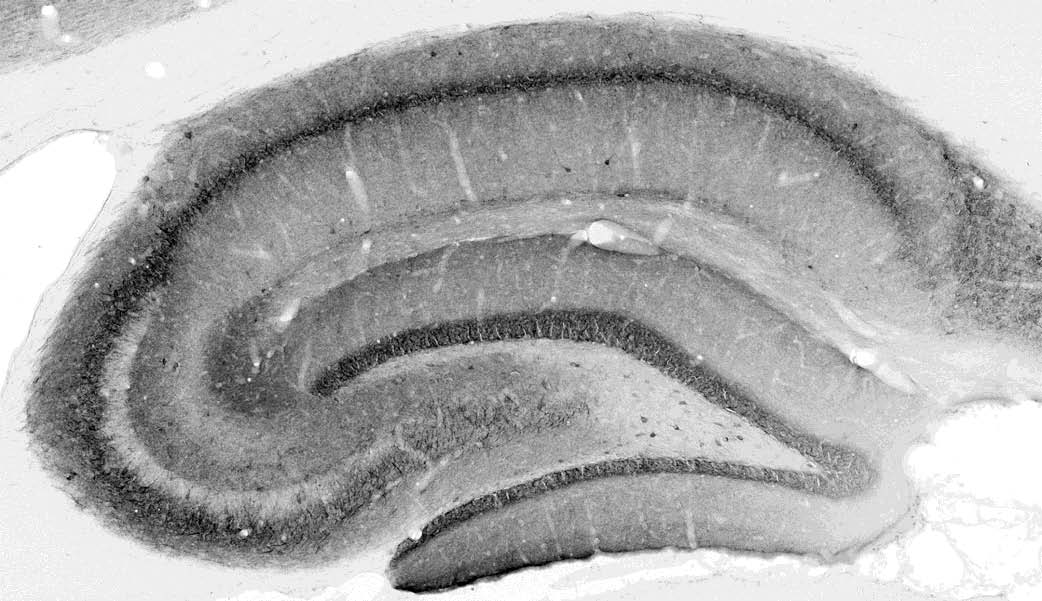 Anti-VGAT Antibody - Image 2
