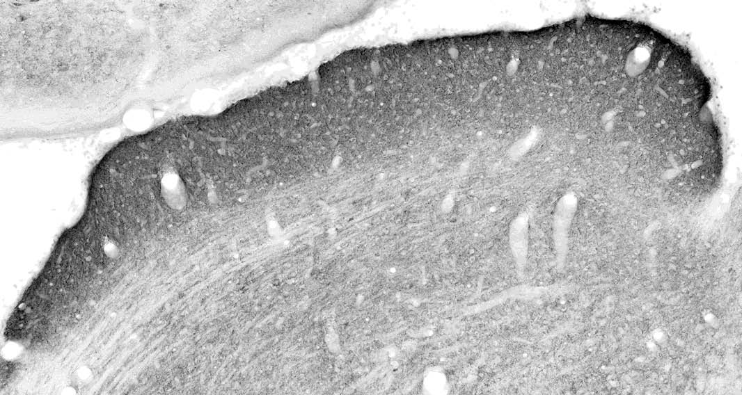 Anti-VGAT Antibody - Image 3