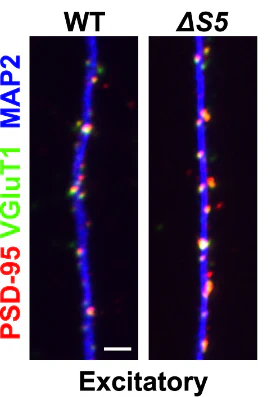 Anti-VGlut1 Antibody - Image 10