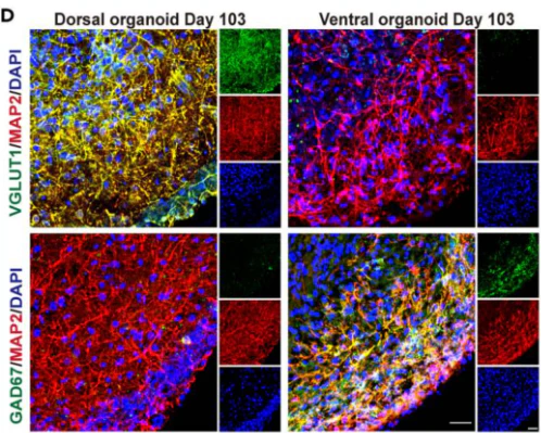 Anti-VGlut1 Antibody - Image 11