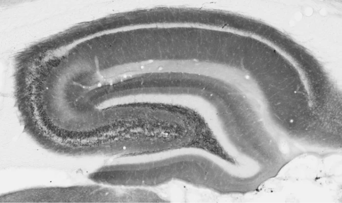 Anti-VGlut1 Antibody - Image 5