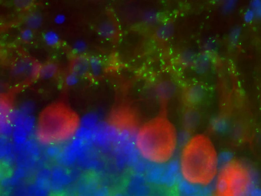 Anti-VGlut2 Antibody - Image 3
