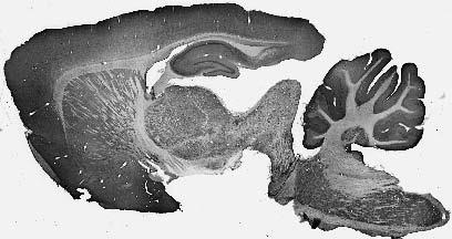 Anti-VGlut3 Antibody
