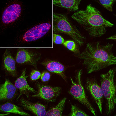 Anti-Vimentin Antibody - Image 10