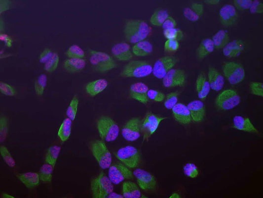 Anti-Vimentin Antibody - Image 11