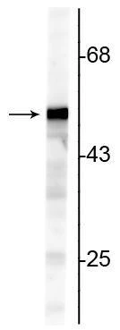 Anti-Vimentin Antibody - Image 2