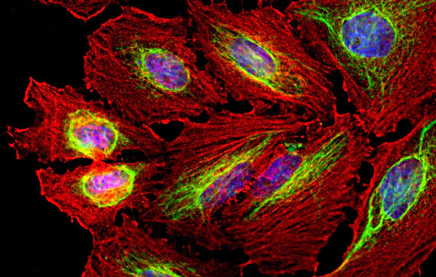Anti-Vimentin Antibody - Image 3