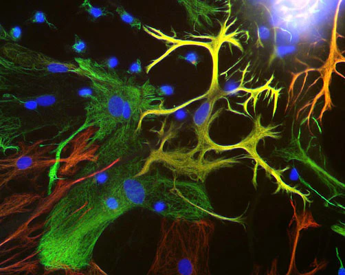 Anti-Vimentin Antibody - Image 4