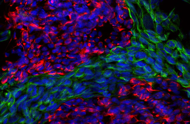 Anti-Vimentin Antibody - Image 6