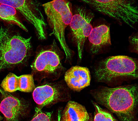 Anti-Vimentin Antibody - Image 7