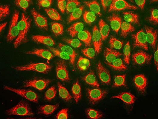 Anti-Vimentin Antibody - Image 8