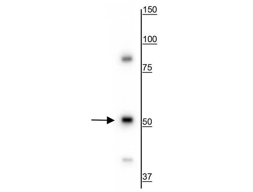 Anti-Vimentin Antibody