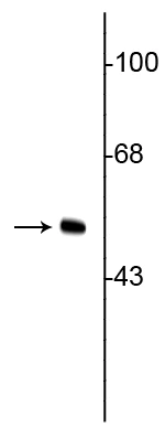 Anti-Vimentin Antibody