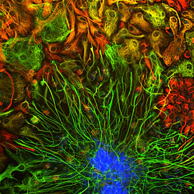 Anti-Vimentin Antibody - Image 2