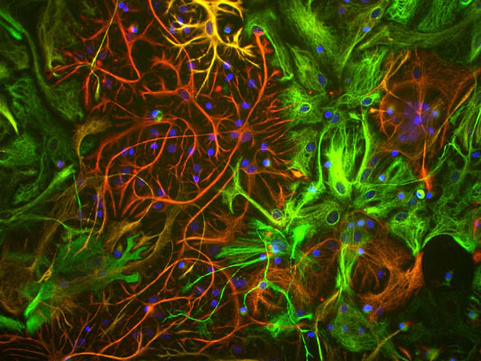 Anti-Vimentin Antibody - Image 3