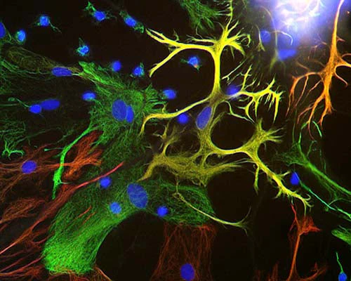 Anti-Vimentin Antibody