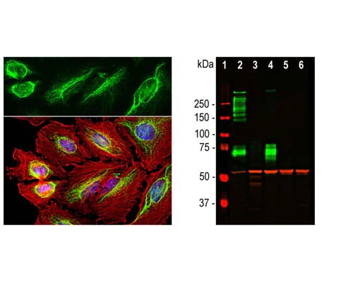 Anti-Vimentin Antibody - Image 3