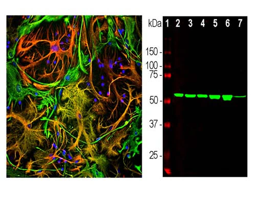 Anti-Vimentin Antibody