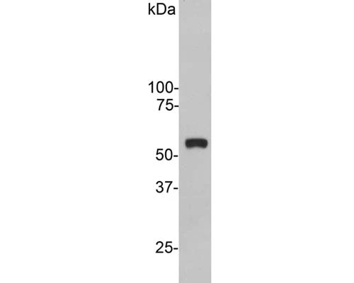 Anti-Vimentin Antibody