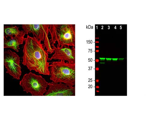 Anti-Vimentin Antibody - Image 3
