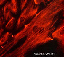 Anti-Vimentin Antibody