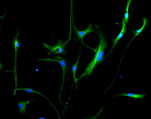 Anti-Vimentin Protein Antibody - Image 2