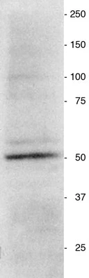 Anti-Vimentin Protein Antibody - Image 3