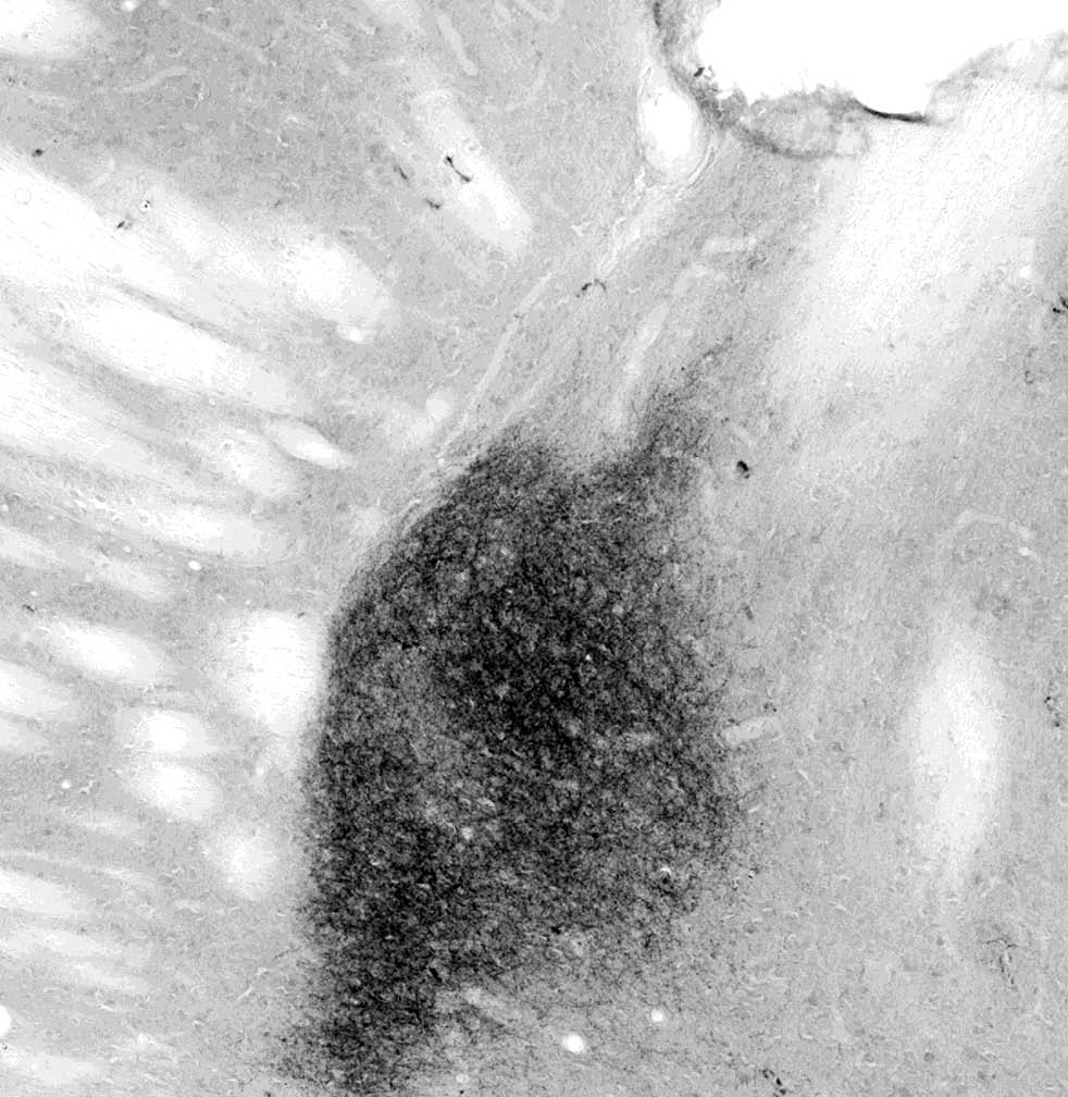 Anti-VIP Antibody - Image 2