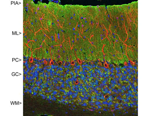 Anti-Visinin-like protein 1 (VLP-1) Antibody - Image 2