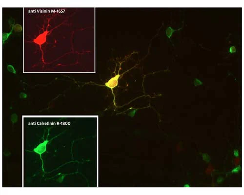 Anti-Visinin-like protein 1 (VLP-1) Antibody - Image 4