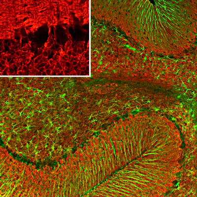 Anti-Visinin-Like Protein 1 (VSNL1) Antibody - Image 2