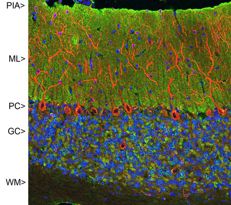 Anti-Visinin-Like Protein 1 (VSNL1) Antibody - Image 3