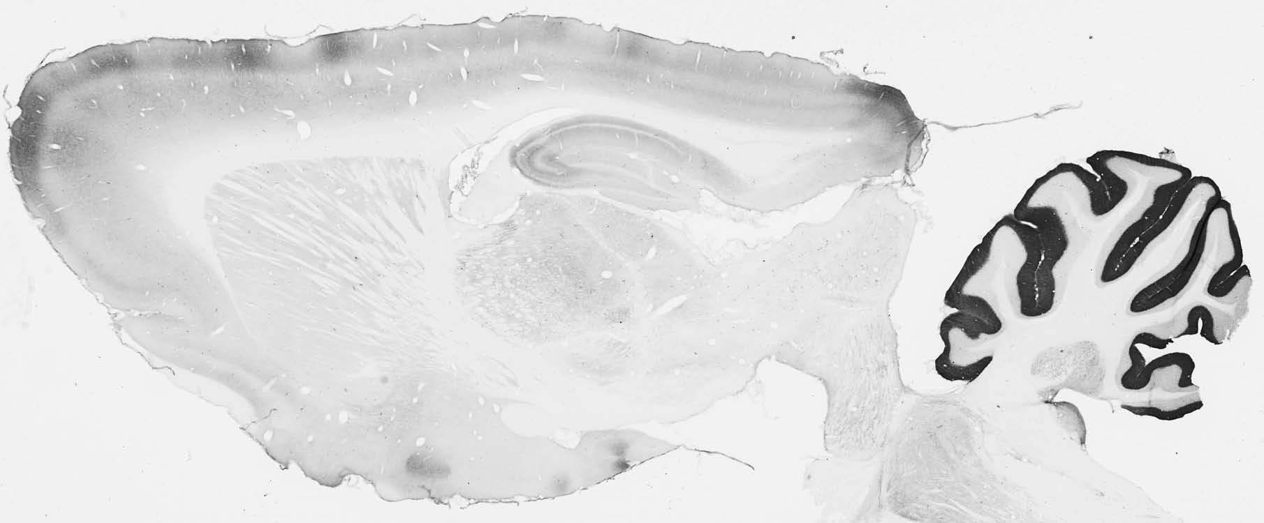 Anti-VMAT1 Antibody