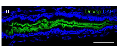 Anti-VSP/TPTE Antibody - Image 2