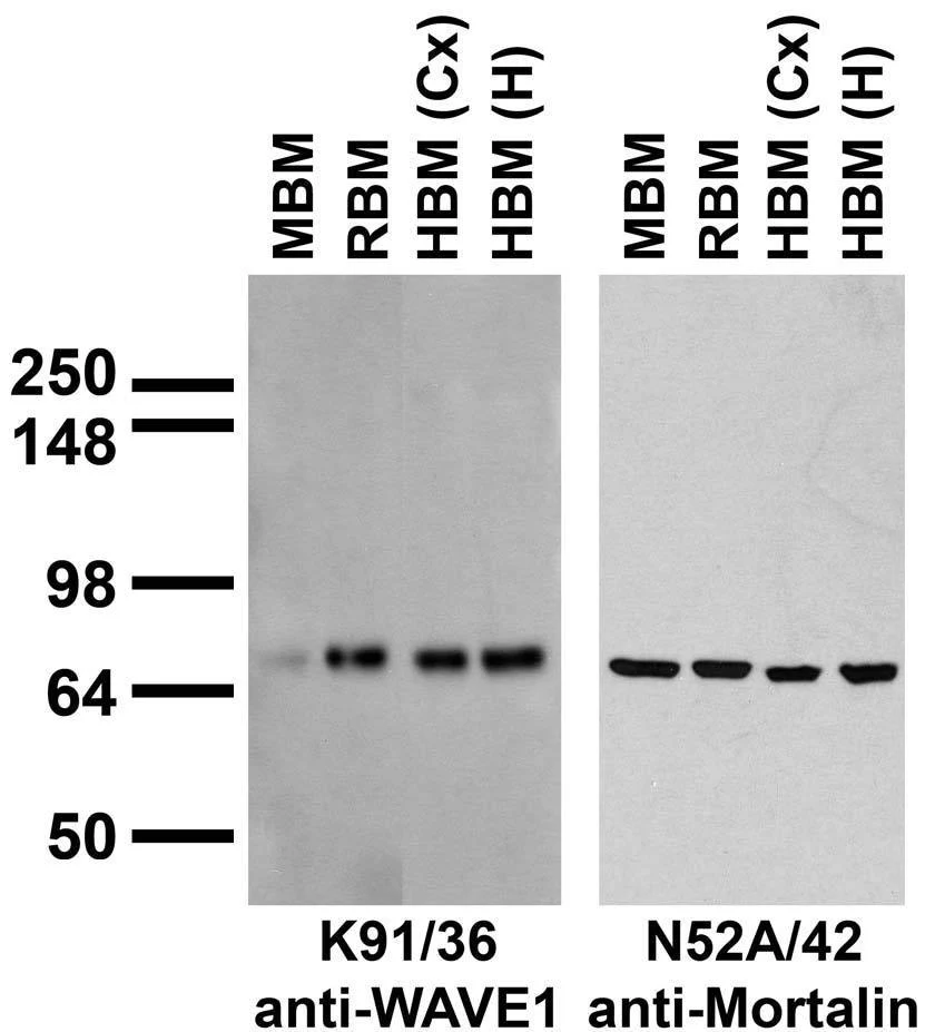 Anti-WAVE1/SCAR Antibody
