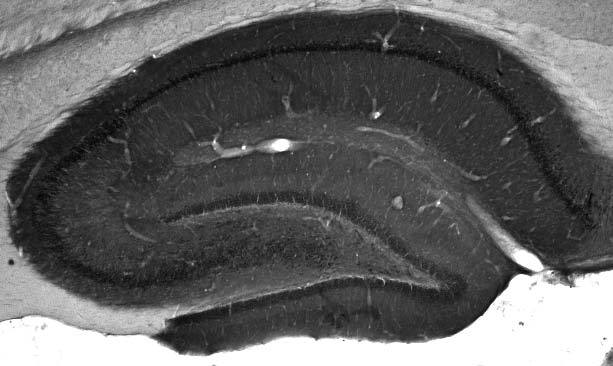 Anti-WAVE1/SCAR Antibody - Image 3