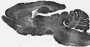 Anti-WAVE1/SCAR Antibody - Image 4