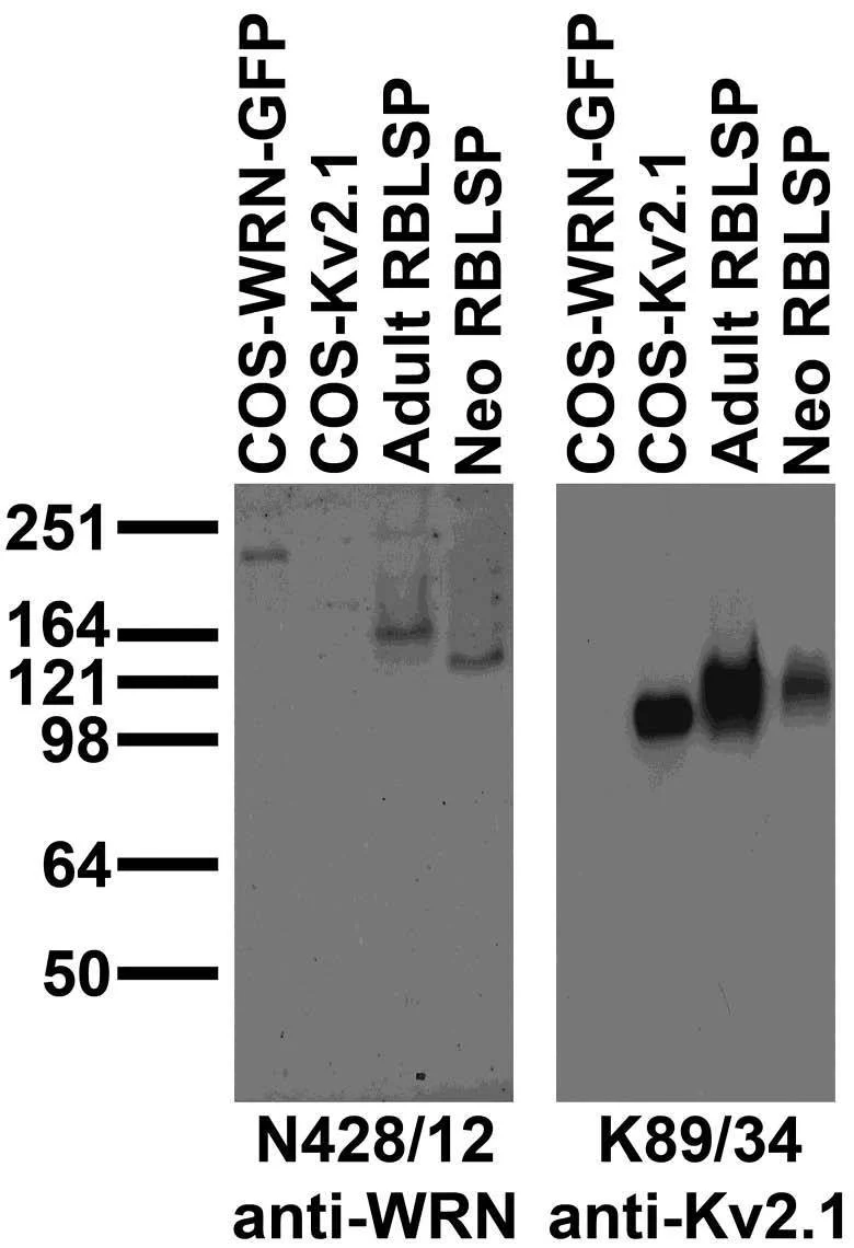 Anti-WRN Antibody