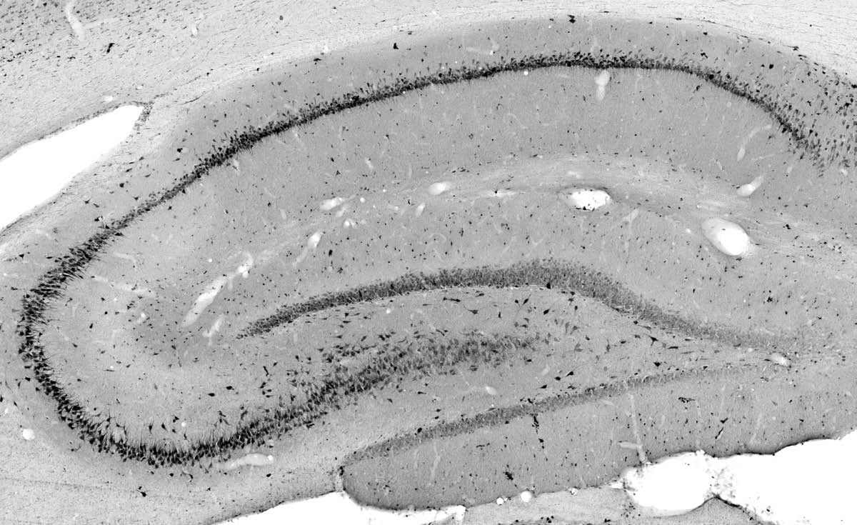 Anti-ZIP3 Antibody
