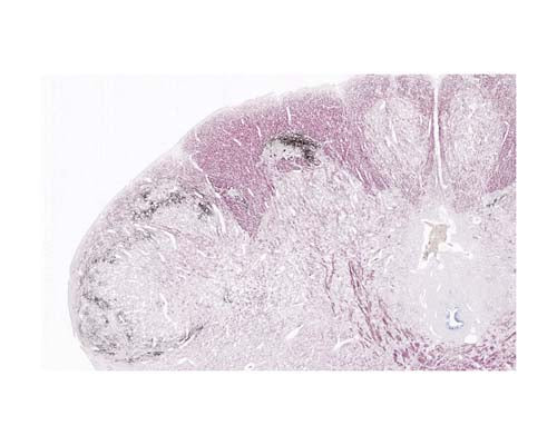 Black-Gold II® Myelin Staining Kit - Image 3