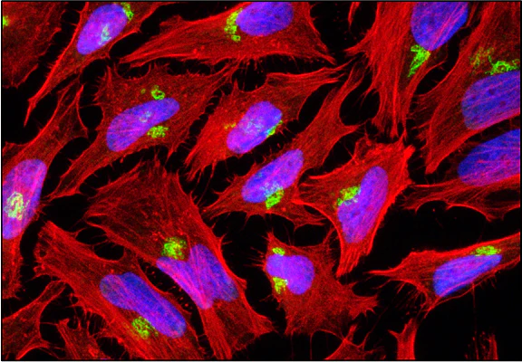 Fluoroshield™ with DAPI