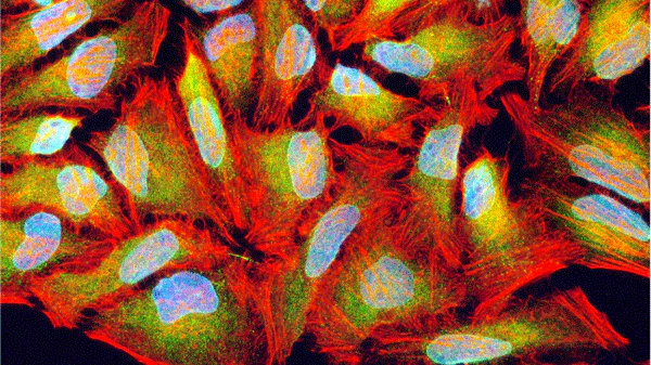 Fluoroshield™ with DAPI - Image 3