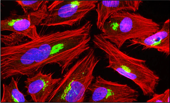 Fluoroshield™ with DAPI - Image 4