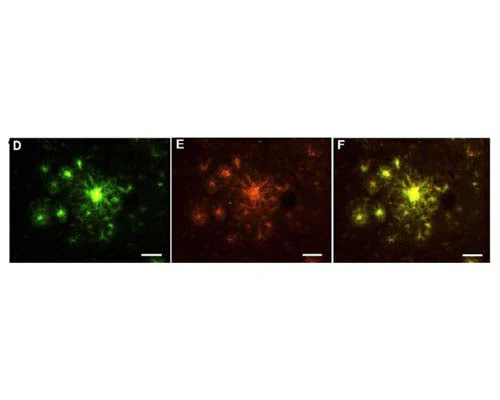 HQ-O RTD Amyloid Plaque Stain Reagent - Image 3