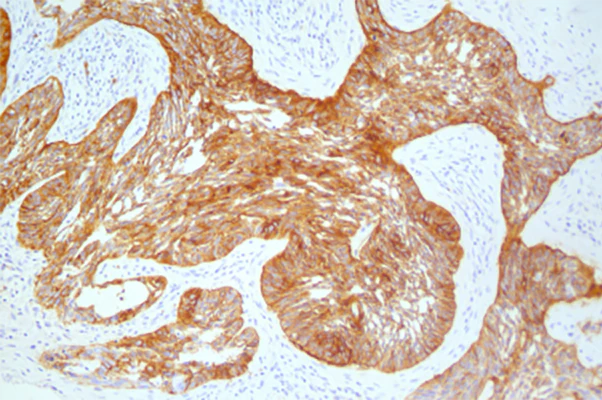 Tris-HCL Buffer, 10X